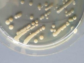 runde, elfenbeinfarbene, leicht glänzende Bakterienkolonien auf Nähragar